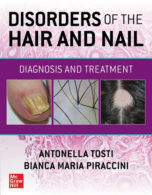 Libro Disorders of the hair and nail: diagnosis and treatment di Antonella Tosti; Bianca Maria Piraccini - ean 9781260462470 - McGraw-Hill Education