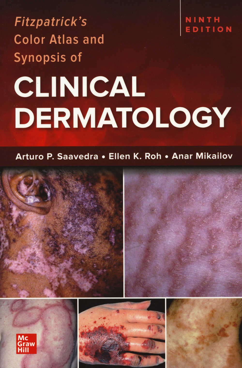 Libro Fitzpatrick's color atlas and synopsis of clinical dermatology di Klaus Wolff; Richard Allen Johnson; Arturo P. Saavedra; Ellen K. Roh - ean 9781264278015 - McGraw-Hill Education