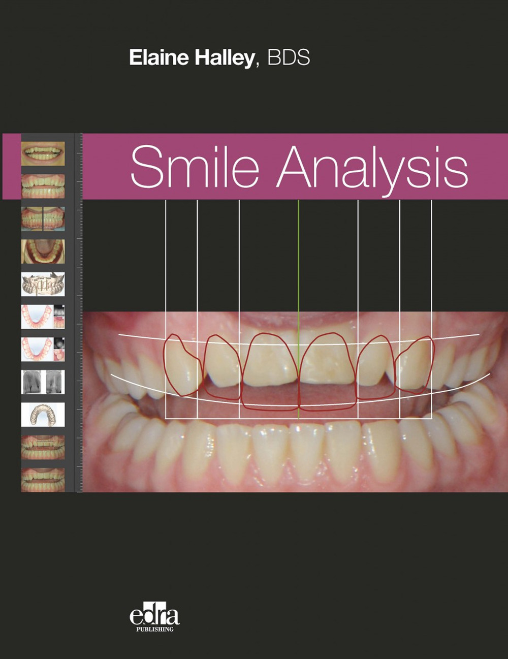 Libro Smile analysis. Ediz. italiana di Elaine Halley - ean 9781737126119 - Edra Publishing