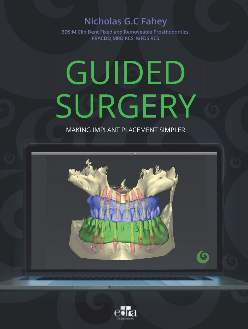 Libro Guided surgery. Making implant placement simpler di Nicholas G.C. Fahey - ean 9781737126171 - Edra Publishing