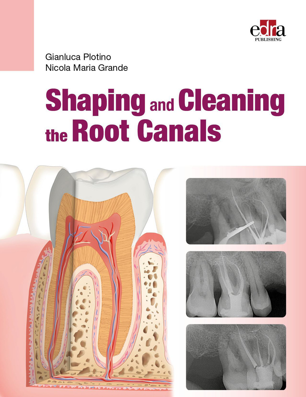 Libro Shaping and Cleaning the Root Canals di Gianluca Plotino; Nicola Maria Grande - ean 9781957260242 - Edra