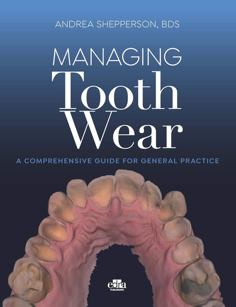 Libro Managing tooth Wear. A comprehensive guide for general practice di Andrea Shepperson - ean 9781957260334 - Edra