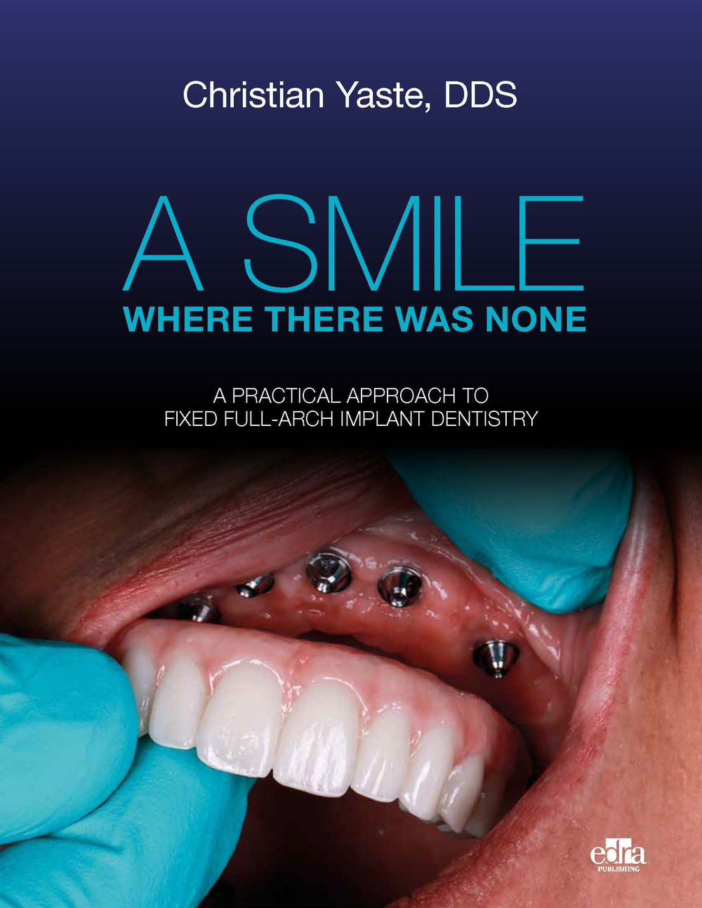 Libro smile where there was none. A pratical approach to fixed full-arch implant dentistry di Christian Yaste - ean 9781957260532 - Edra