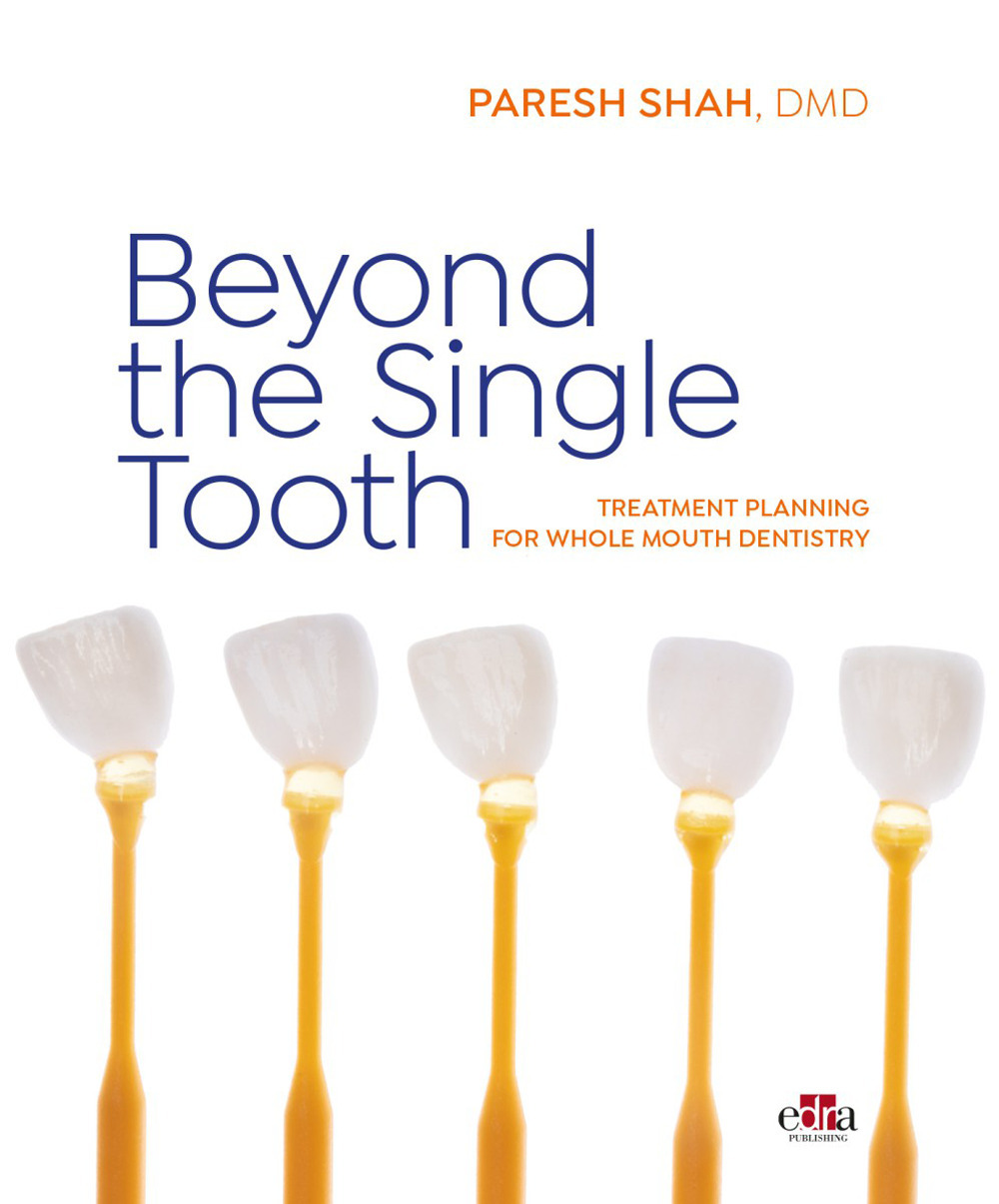 Libro Beyond the Single Tooth. Treatment planning for whole mouth dentistry di Paresh Shah - ean 9781957260907 - Edra