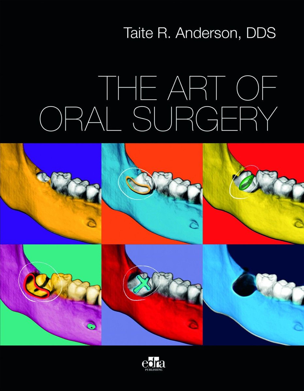 Libro art of oral surgery di Anderson R. Taite - ean 9781962679251 - Edra