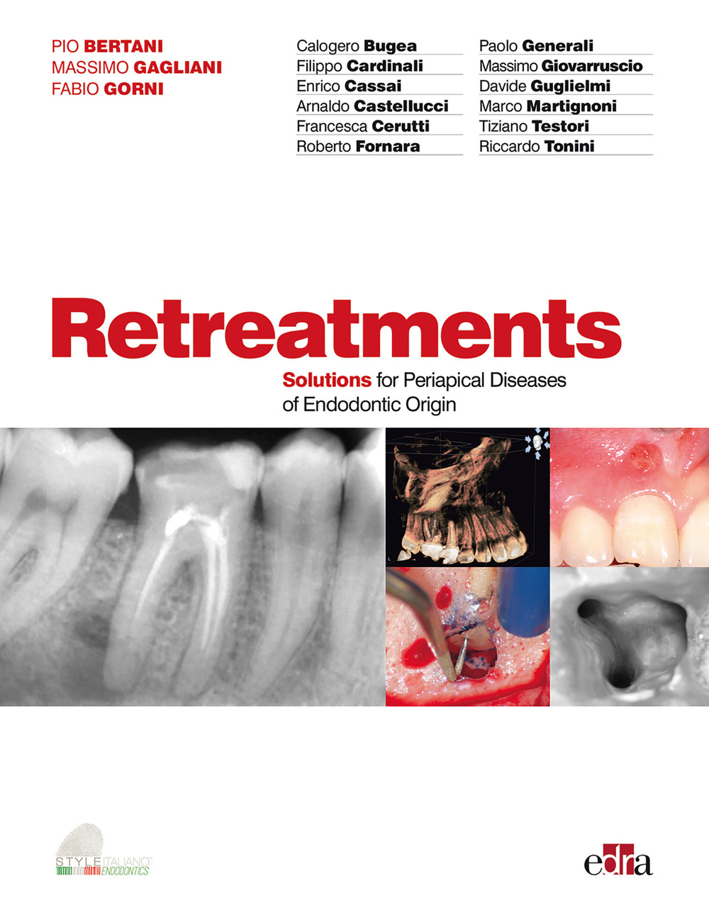 Libro Retreatments. Solutions for periapical diseases of endodontic origin di - ean 9788821450938 - Edra