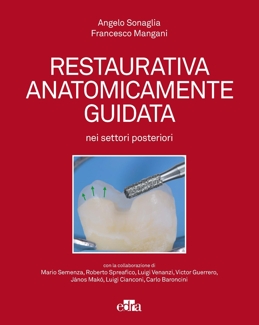 Libro Restaurativa anatomicamente guidata nei settori posteriori di Angelo Sonaglia; Francesco Mangani - ean 9788821452604 - Edra