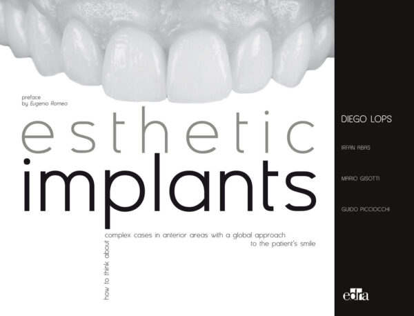 Libro Esthetic implants. How to think about complex cases in anterior areas with a global approach to the patient' s smile di Diego Lops; Mario Gisotti; Guido Picciocchi; Irfan Abas - ean 9788821453267 - Edra