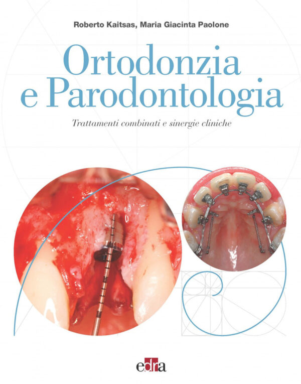 Libro Ortodonzia e parodontologia. Trattamenti combinati e sinergie cliniche di Roberto Kaitsas; Maria Giacinta Paolone - ean 9788821453663 - Edra