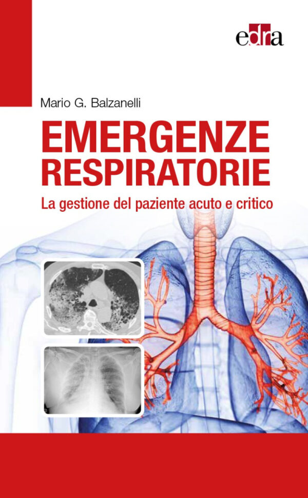 Libro Emergenze respiratorie. La gestione del paziente acuto e critico di Mario Giosuè Balzanelli - ean 9788821455018 - Edra