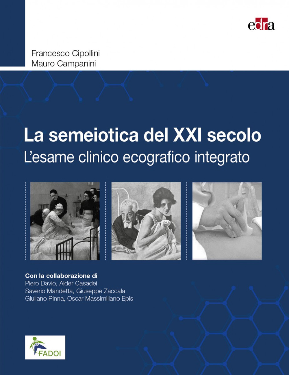 Libro semeiotica del XXI secolo. L'esame clinico ecografico integrato di Francesco Cipollini; Mauro Campanini - ean 9788821455162 - Edra
