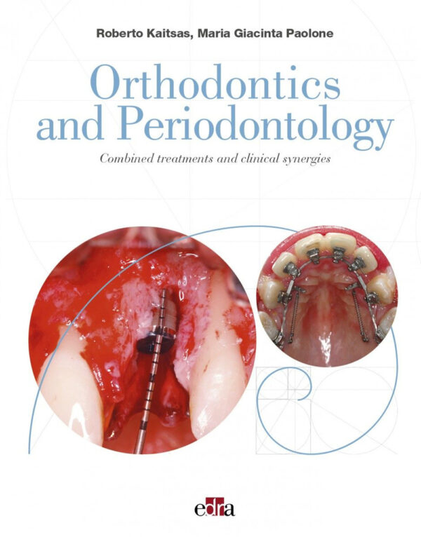 Libro Orthodontics and Periodontology. Combined treatments and clinical synergies di Roberto Kaitsas; Maria Giacinta Paolone - ean 9788821455322 - Edra