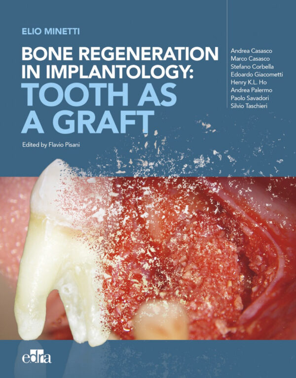 Libro Bone regeneration in implantology: tooth as a graft di Elio Minetti - ean 9788821455346 - Edra