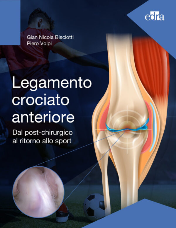 Libro Legamento crociato anteriore. Dal post-chirurgico al ritorno allo sport di Gian Nicola Bisciotti; Piero Volpi - ean 9788821456442 - Edra