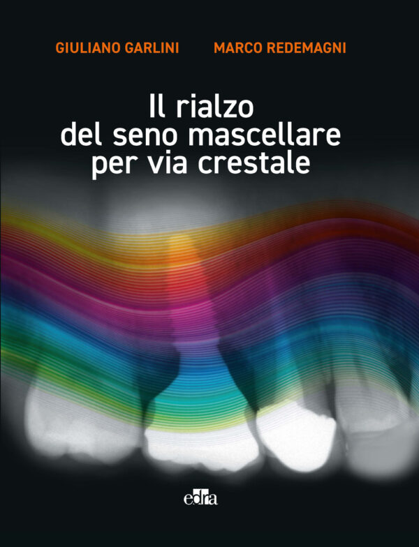 Libro rialzo del seno mascellare per via crestale di Giuliano Garlini; Marco Redemagni - ean 9788821457180 - Edra