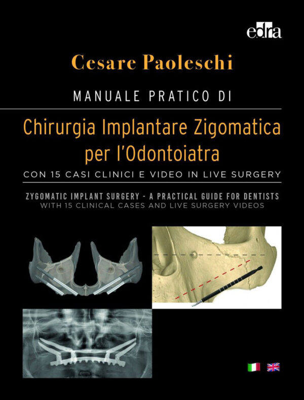 Libro Manuale pratico di chirurgia implantare zigomatica per l’odontoiatra. Con 15 casi clinici e video in live surgery-Zygomatic implant surgery. A practical guide for dentist. With 15 clinical cases and live surgery videos di Cesare Paoleschi - ean 9788821457371 - Edra