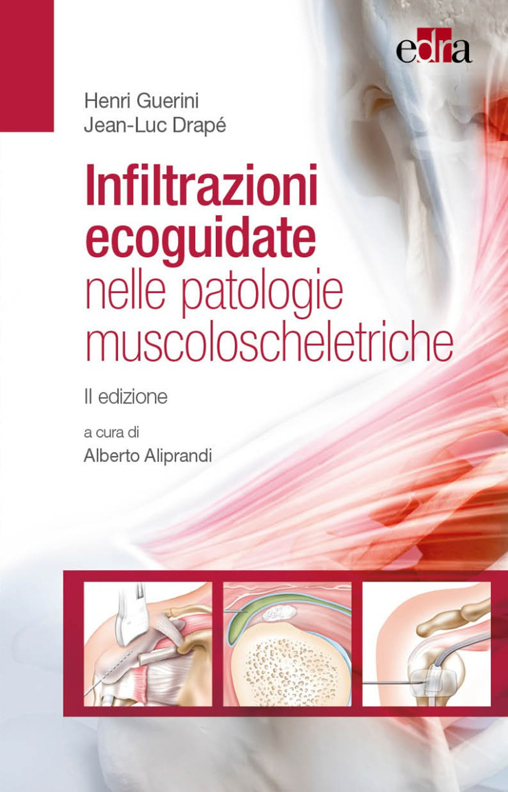 Libro Infiltrazioni ecoguidate nelle patologie muscoloscheletriche di Henri Guerin; Jean-Luc Drapè - ean 9788821457388 - Edra