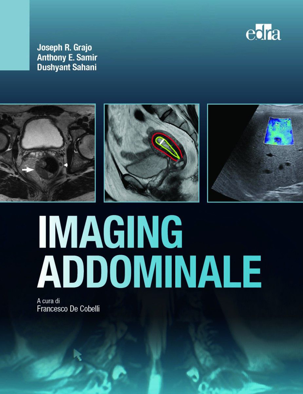 Libro Imaging addominale di Joseph R. Grajo; Dushyant Sahani; Anthony E. Samir - ean 9788821457487 - Edra