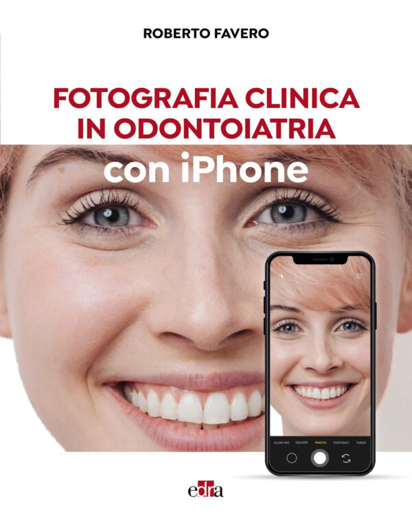 Libro Fotografia clinica in odontoiatria con iPhone di Roberto Favero - ean 9788821457920 - Edra