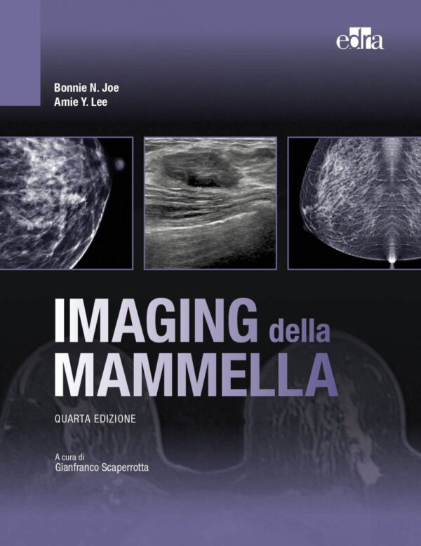 Libro Imaging della mammella di Bonnie N. Joe; Amie Y. Lee - ean 9788821458217 - Edra