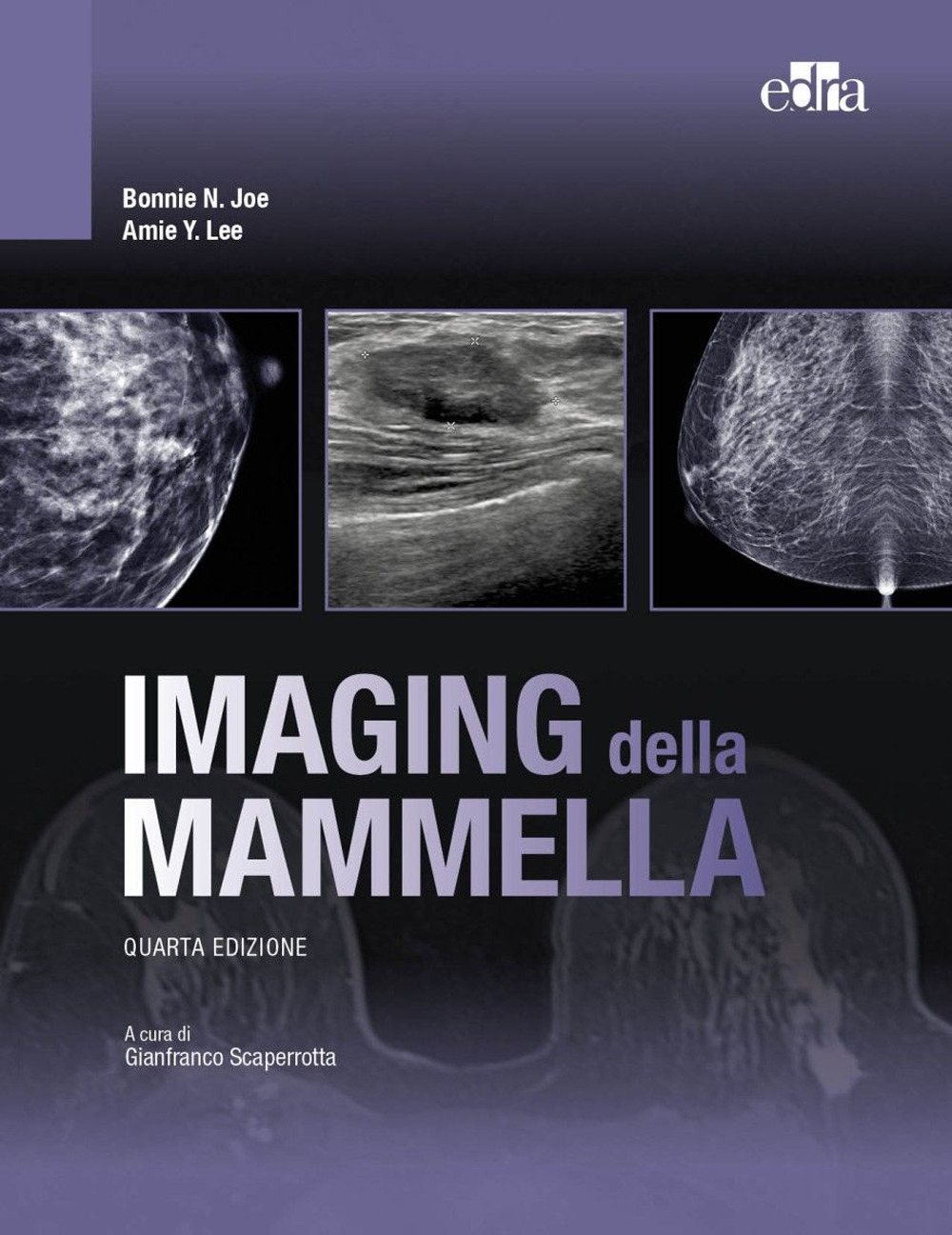 Libro Imaging della mammella di Bonnie N. Joe; Amie Y. Lee - ean 9788821458217 - Edra