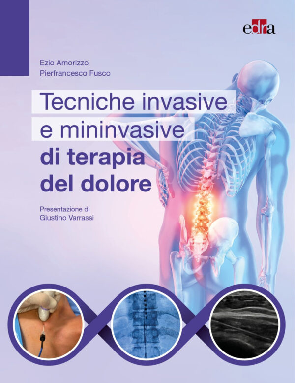 Libro Tecniche invasive e mininvasive di terapia del dolore di Ezio Amorizzo; Pierfrancesco Fusco - ean 9788821458439 - Edra