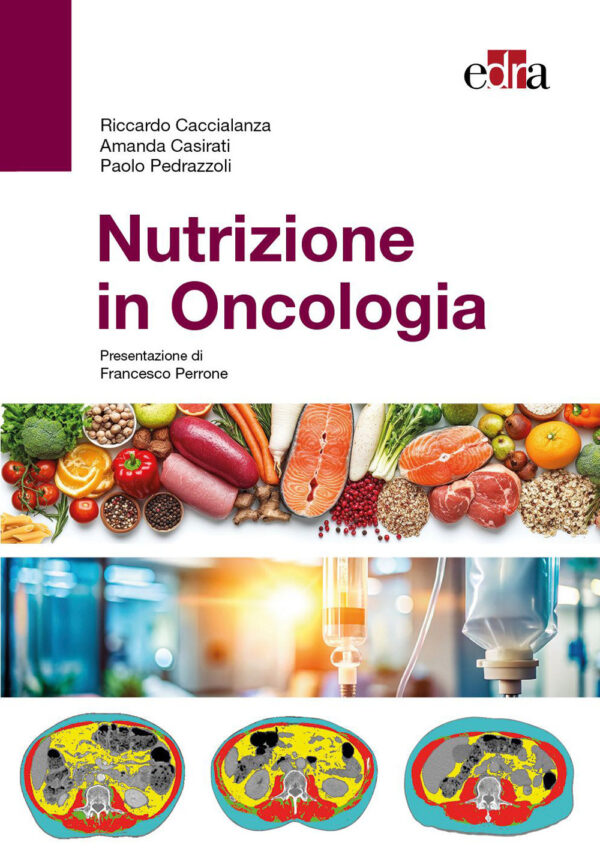 Libro Nutrizione in oncologia di Riccardo Caccialanza; Amanda Casirati; Paolo Pedrazzoli - ean 9788821459092 - Edra