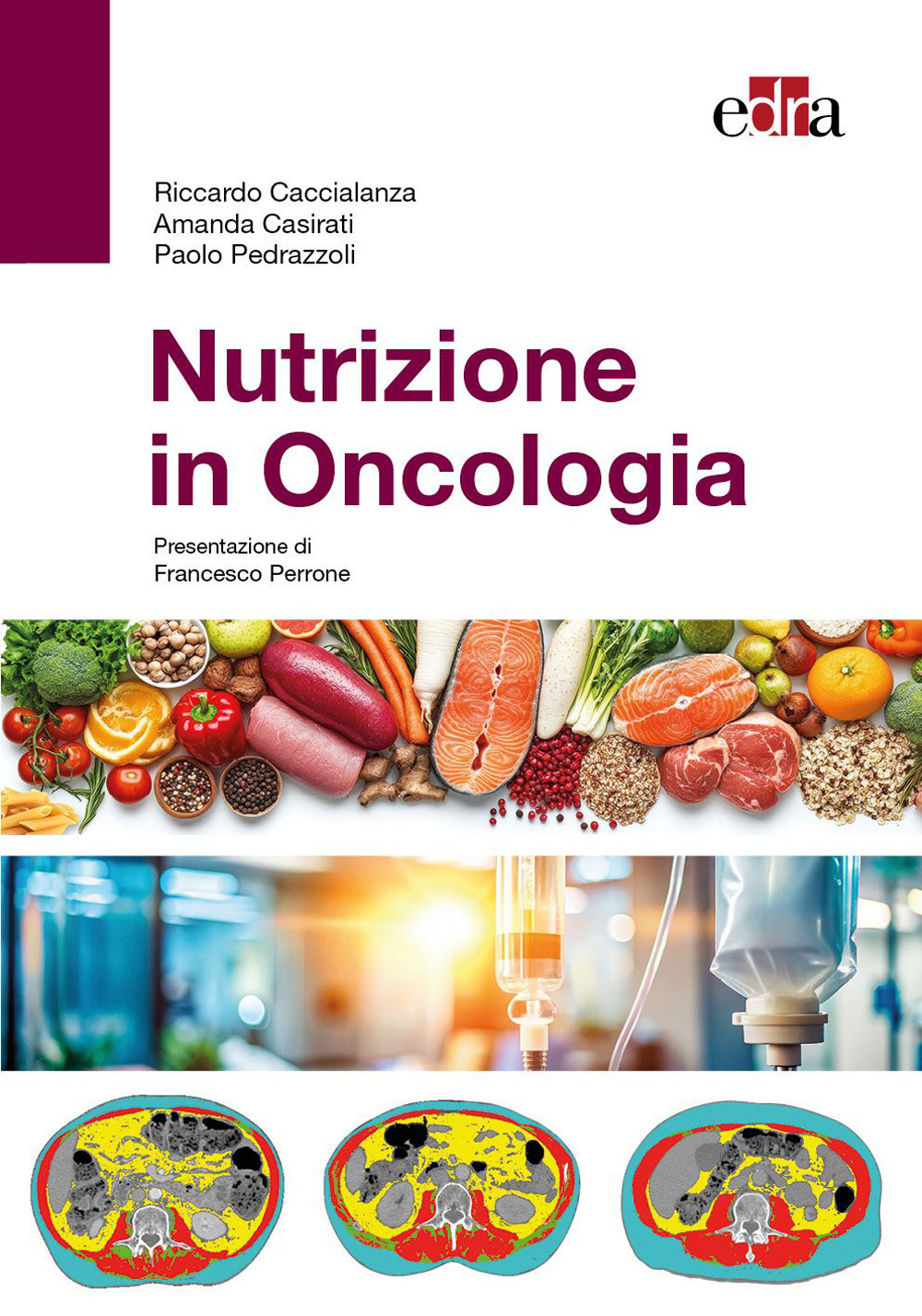 Libro Nutrizione in oncologia di Riccardo Caccialanza; Amanda Casirati; Paolo Pedrazzoli - ean 9788821459092 - Edra