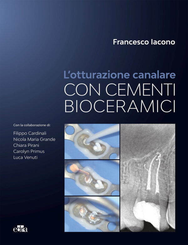 Libro otturazione canalare con cementi bioceramici di Francesco Iacono - ean 9788821459115 - Edra