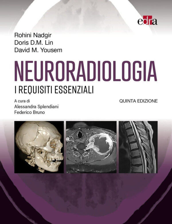 Libro Neuroradiologia. I requisiti essenziali di Rohini Nadgir; Doris D. M. Lin; David M. Yousem - ean 9788821459184 - Edra