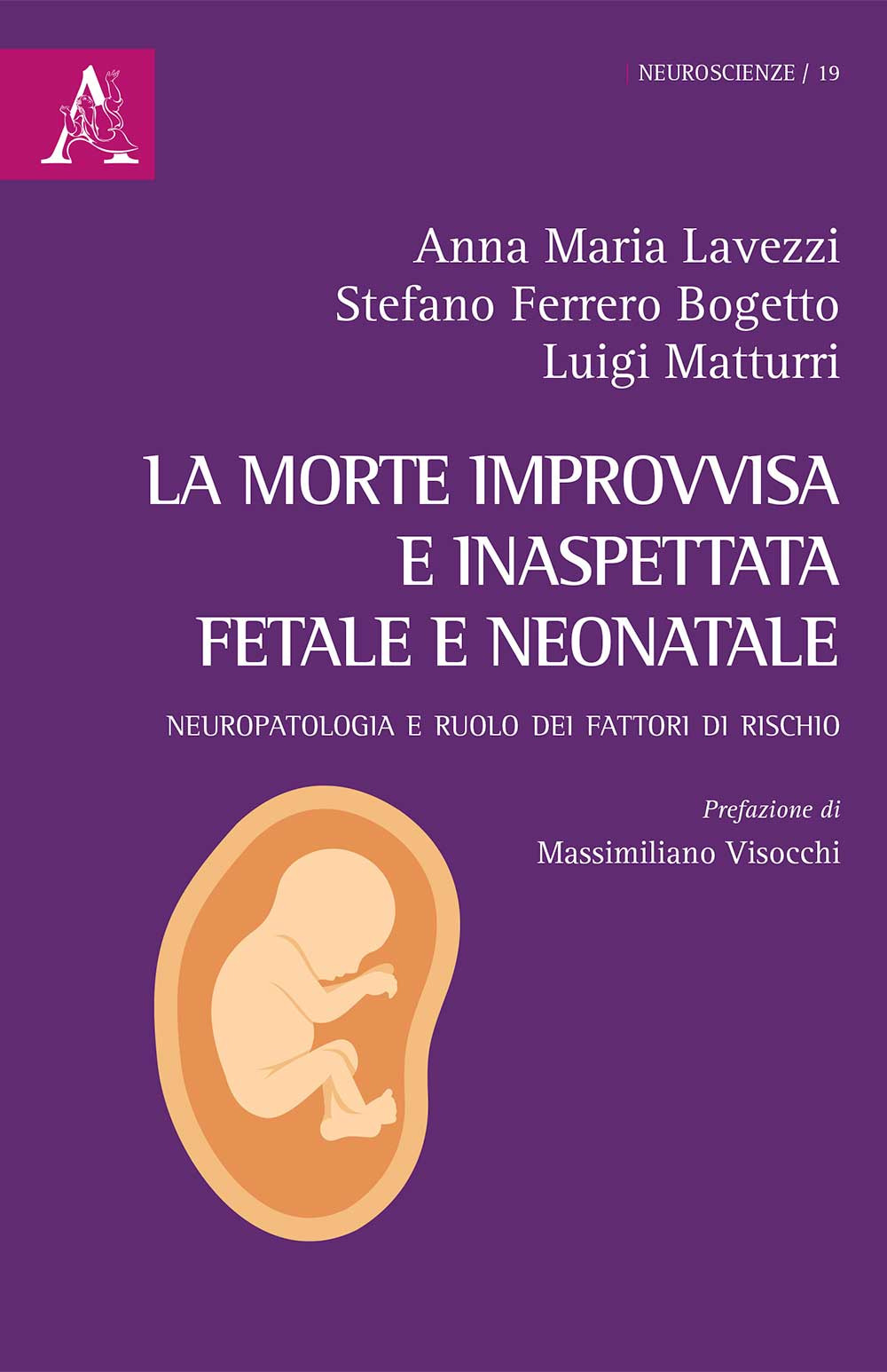 Libro morte improvvisa e inaspettata fetale e neonatale. Neuropatologia e ruolo dei fattori di rischio di Anna Maria Lavezzi; Stefano Bogetto; Luigi Matturri - ean 9788825532364 - Aracne